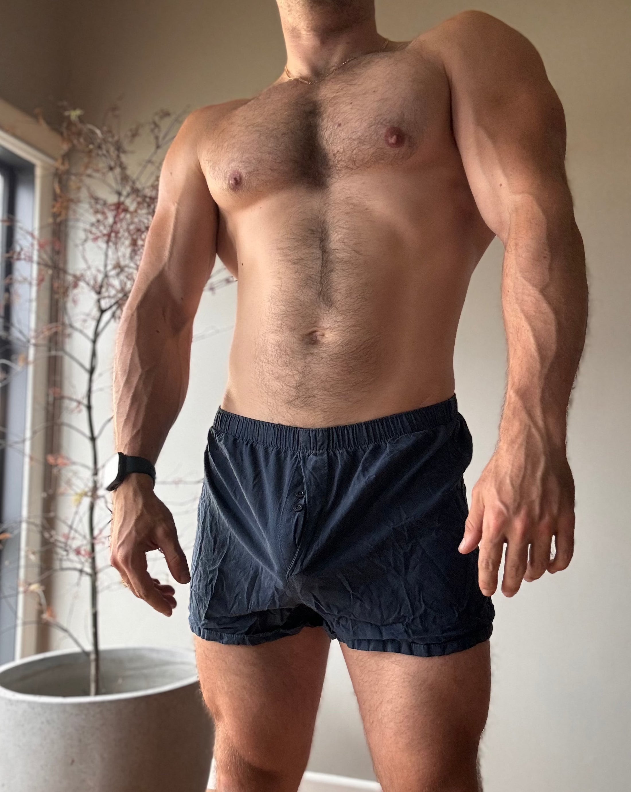 Boxers